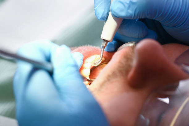 Best Emergency Dental Care for Broken or Chipped Teeth in Battle Ground, IN